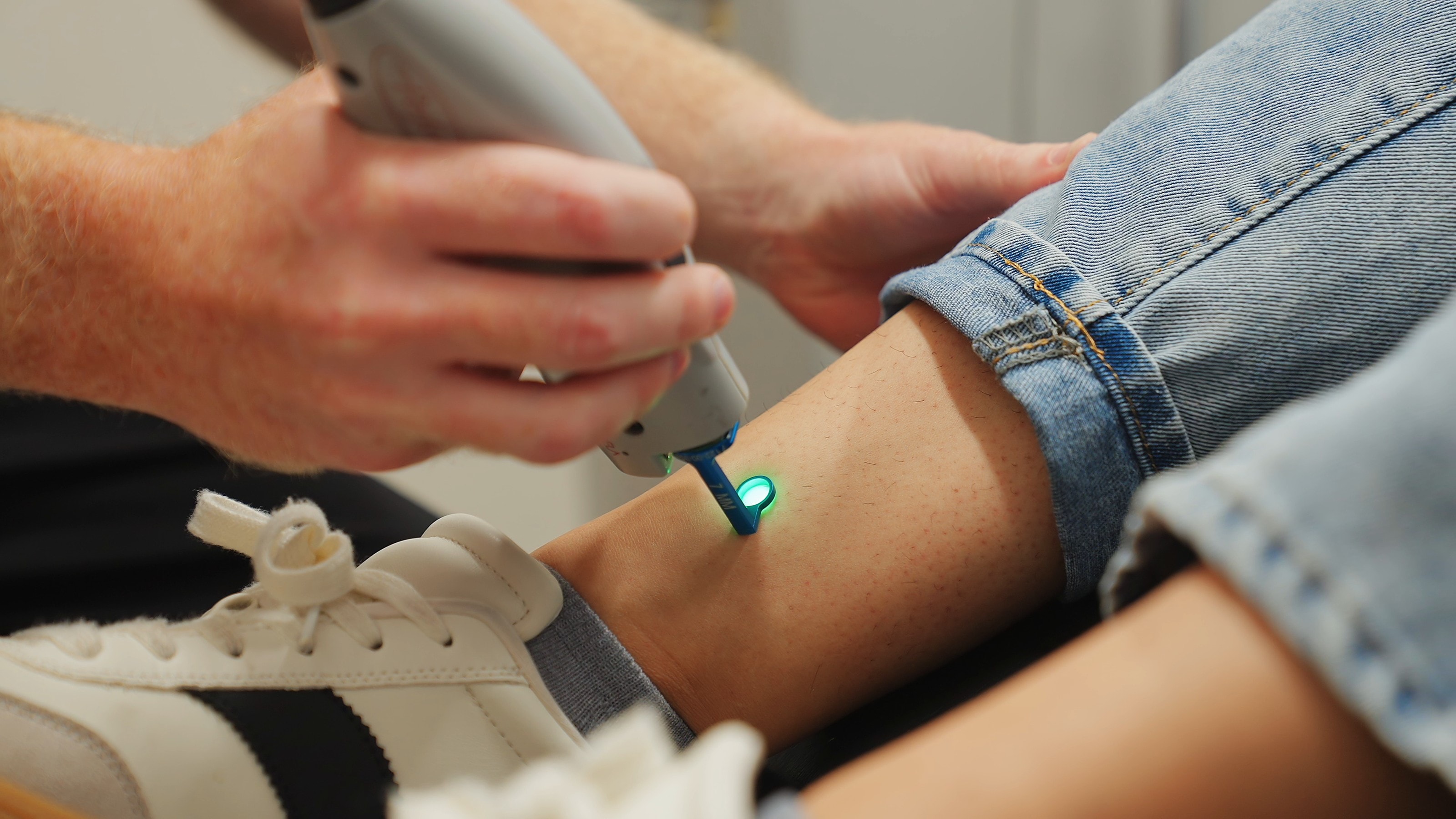 A laser handpiece with its green aiming light, guided across the skin