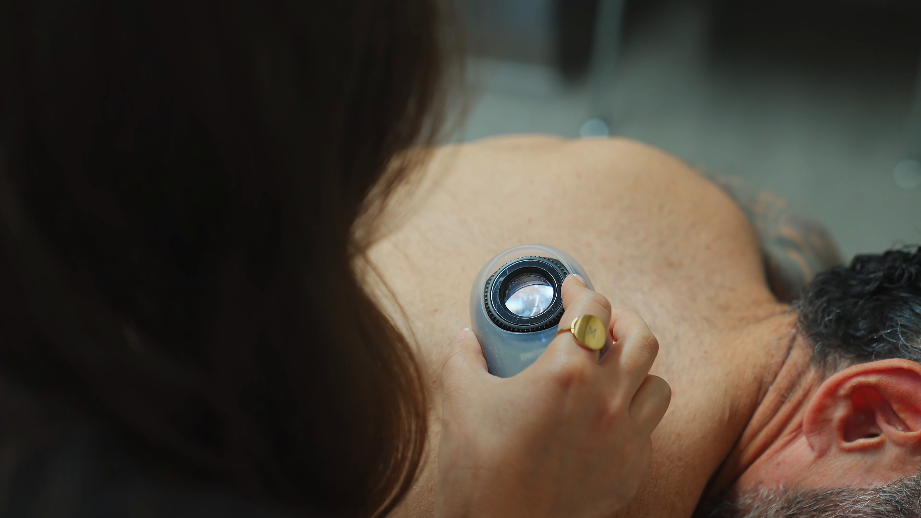A dermatoscope held to a patient's skin during an examination
